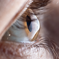 cornea